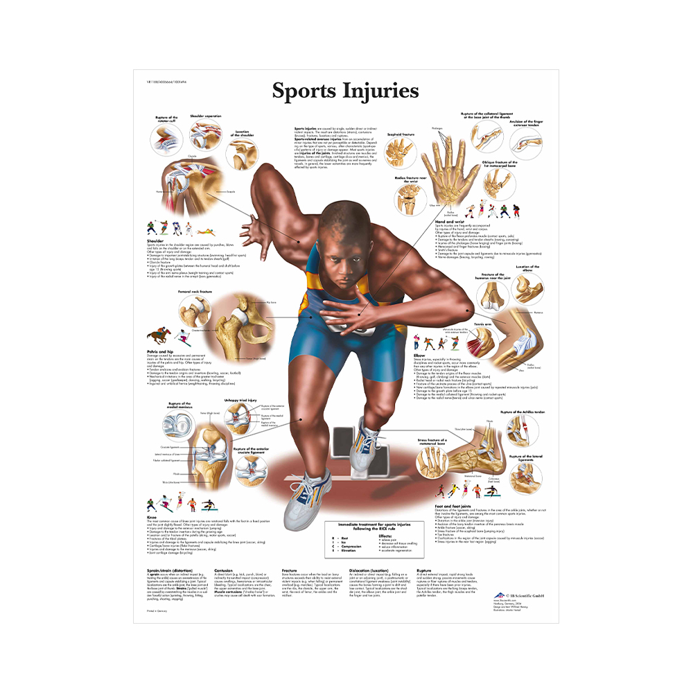 Anatomisk Plansch “Sports Injury” 66 x 51 cm